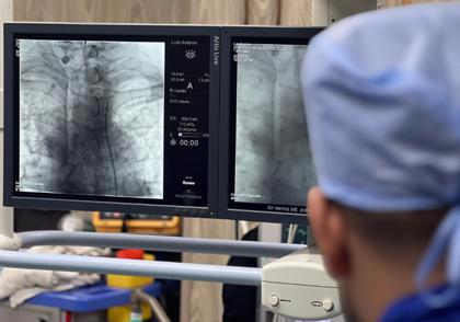 neurovascular-catheterization